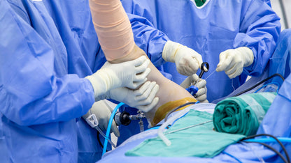 ARTHROSCOPY SHOULDER - SH 100
